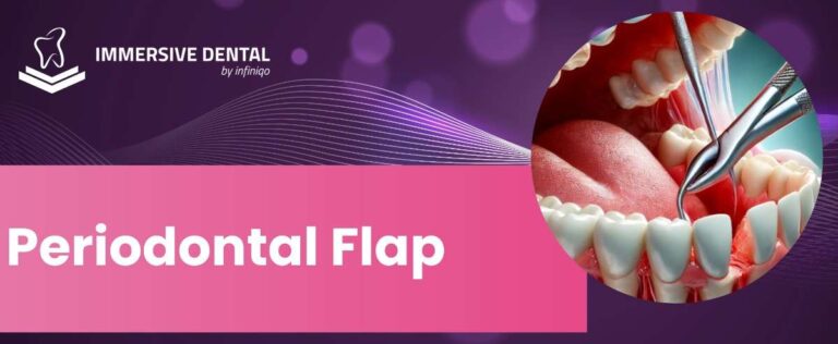 Periodontalfla